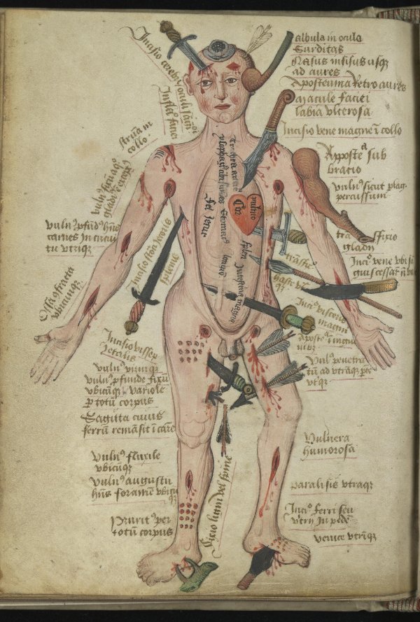 wound man 15th c anatomical treatise